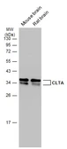 Anti-CLTA antibody [N1C3] used in Western Blot (WB). GTX101939