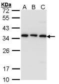 Anti-CKAP1 antibody [N1C3] used in Western Blot (WB). GTX101940