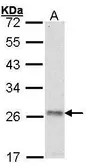 Anti-ATP5O antibody [N1C3] used in Western Blot (WB). GTX101942