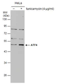 Anti-ATF4 antibody used in Western Blot (WB). GTX101944