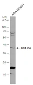 Anti-DNAJB6 antibody used in Western Blot (WB). GTX101946