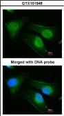 Anti-DNAJB6 antibody used in Immunocytochemistry/ Immunofluorescence (ICC/IF). GTX101946