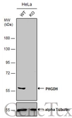 Anti-PHGDH antibody [N1N2], N-term used in Western Blot (WB). GTX101948