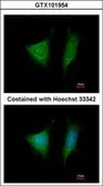 Anti-EIF3 beta antibody [N2C3] used in Immunocytochemistry/ Immunofluorescence (ICC/IF). GTX101954