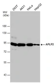 Anti-APLP2 antibody [N1N2], N-term used in Western Blot (WB). GTX101970