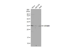 Anti-OTUB1 antibody [N1C1] used in Western Blot (WB). GTX101973