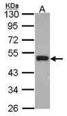 Anti-Peripherin antibody [N1N3] used in Western Blot (WB). GTX101974