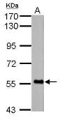 Anti-FBXO7 antibody used in Western Blot (WB). GTX101986