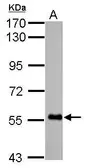 Anti-FBXO7 antibody used in Western Blot (WB). GTX101986
