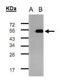 Anti-TADA3L antibody [C1C3] used in Western Blot (WB). GTX101991