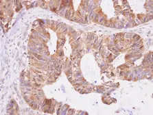 Anti-Aspartyl aminopeptidase antibody [N1N3] used in IHC (Paraffin sections) (IHC-P). GTX101993