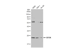 Anti-EIF3K antibody used in Western Blot (WB). GTX101995