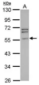 Anti-Peripherin antibody used in Western Blot (WB). GTX102005