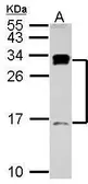 Anti-C1D antibody used in Western Blot (WB). GTX102013