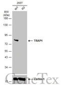 Anti-TRAP1 antibody used in Western Blot (WB). GTX102017