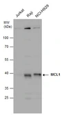 Anti-MCL1 antibody used in Western Blot (WB). GTX102026