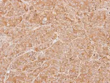Anti-ZNHIT1 antibody [N1C3] used in IHC (Paraffin sections) (IHC-P). GTX102030