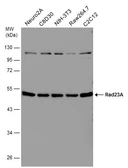 Anti-RAD23A antibody [N3C3] used in Western Blot (WB). GTX102032