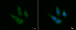 Anti-PTOV1 antibody used in Immunocytochemistry/ Immunofluorescence (ICC/IF). GTX102033