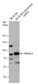 Anti-AFG3L2 antibody [N1N2], N-term used in Western Blot (WB). GTX102036