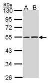 Anti-RUVBL2 antibody [C1C3] used in Western Blot (WB). GTX102037