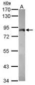 Anti-MYST2 antibody [N2C1], Internal used in Western Blot (WB). GTX102041