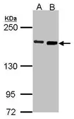 Anti-DIAPH1 antibody [N1N2], N-term used in Western Blot (WB). GTX102042