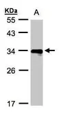 Anti-HLA-DR beta antibody [N1C3] used in Western Blot (WB). GTX102047