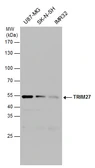Anti-TRIM27 antibody used in Western Blot (WB). GTX102048
