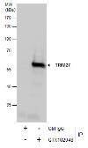 Anti-TRIM27 antibody used in Immunoprecipitation (IP). GTX102048