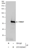 Anti-TRIM27 antibody used in Immunoprecipitation (IP). GTX102048
