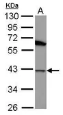 Anti-Hsp40 antibody [N1C1] used in Western Blot (WB). GTX102049