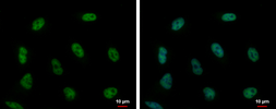 Anti-PUF60 antibody used in Immunocytochemistry/ Immunofluorescence (ICC/IF). GTX102051