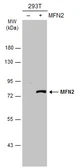 Anti-MFN2 antibody [N1N2], N-term used in Western Blot (WB). GTX102055
