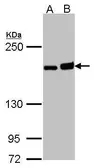Anti-DIAPH1 antibody [C2C3], C-term used in Western Blot (WB). GTX102057