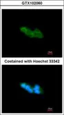 Anti-ARMET antibody [N1C3] used in Immunocytochemistry/ Immunofluorescence (ICC/IF). GTX102060