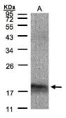 Anti-ARMET antibody [N1C3] used in Western Blot (WB). GTX102060