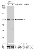 Anti-hnRNP H antibody [N1C1] used in Western Blot (WB). GTX102061