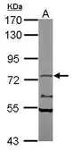 Anti-TAP antibody [C2C3], C-term used in Western Blot (WB). GTX102063