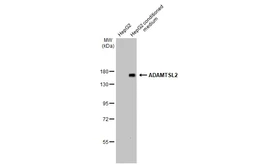Anti-ADAMTSL2 antibody [C3], C-term used in Western Blot (WB). GTX102069