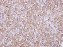 Anti-Profilin 1 antibody [N1C3] used in IHC (Paraffin sections) (IHC-P). GTX102072