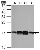 Anti-Profilin 1 antibody [N1C3] used in Western Blot (WB). GTX102072