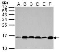 Anti-Profilin 1 antibody [N1C3] used in Western Blot (WB). GTX102072