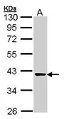 Anti-Transaldolase antibody used in Western Blot (WB). GTX102076