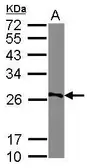 Anti-AGPAT1 antibody [N3C3] used in Western Blot (WB). GTX102081