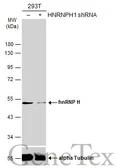 Anti-hnRNP H antibody [C1C3] used in Western Blot (WB). GTX102083