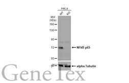 Anti-NFkB p65 antibody used in Western Blot (WB). GTX102090