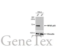 Anti-NFkB p65 antibody used in Western Blot (WB). GTX102090