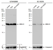 Anti-MRLC2 antibody used in Western Blot (WB). GTX102091