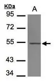 Anti-beta Tubulin 4 antibody used in Western Blot (WB). GTX102095